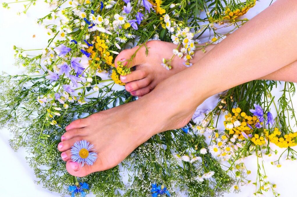 Varices