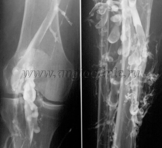 Exploración por ultrasonido